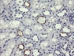 MDM4 Antibody in Immunohistochemistry (Paraffin) (IHC (P))