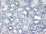 MDM4 Antibody in Immunohistochemistry (Paraffin) (IHC (P))