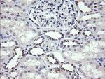 MDM4 Antibody in Immunohistochemistry (Paraffin) (IHC (P))