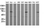 MDM4 Antibody in Western Blot (WB)