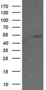 MDM4 Antibody in Western Blot (WB)