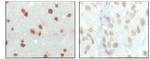 MDMX Antibody in Immunohistochemistry (Paraffin) (IHC (P))