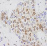 CRSP1/TRAP220 Antibody in Immunohistochemistry (IHC)