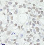 MED12 Antibody in Immunohistochemistry (IHC)