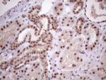 MED15 Antibody in Immunohistochemistry (Paraffin) (IHC (P))