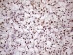 MED15 Antibody in Immunohistochemistry (Paraffin) (IHC (P))