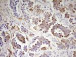 MED15 Antibody in Immunohistochemistry (Paraffin) (IHC (P))