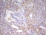 MED15 Antibody in Immunohistochemistry (Paraffin) (IHC (P))