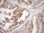 MED15 Antibody in Immunohistochemistry (Paraffin) (IHC (P))