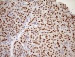 MED15 Antibody in Immunohistochemistry (Paraffin) (IHC (P))