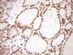 MED15 Antibody in Immunohistochemistry (Paraffin) (IHC (P))