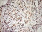 MED15 Antibody in Immunohistochemistry (Paraffin) (IHC (P))