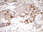 MED15 Antibody in Immunohistochemistry (Paraffin) (IHC (P))