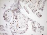 MED15 Antibody in Immunohistochemistry (Paraffin) (IHC (P))