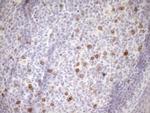 MED15 Antibody in Immunohistochemistry (Paraffin) (IHC (P))