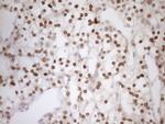 MED15 Antibody in Immunohistochemistry (Paraffin) (IHC (P))