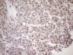 MED15 Antibody in Immunohistochemistry (Paraffin) (IHC (P))