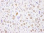 MEF2A Antibody in Immunohistochemistry (IHC)