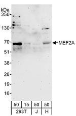 MEF2A Antibody in Western Blot (WB)