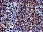 MEF2C Antibody in Immunohistochemistry (Paraffin) (IHC (P))