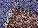 MEF2C Antibody in Immunohistochemistry (Paraffin) (IHC (P))