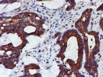 MEF2C Antibody in Immunohistochemistry (Paraffin) (IHC (P))