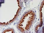 MEF2C Antibody in Immunohistochemistry (Paraffin) (IHC (P))