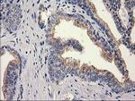 MEF2C Antibody in Immunohistochemistry (Paraffin) (IHC (P))