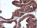 MEF2C Antibody in Immunohistochemistry (Paraffin) (IHC (P))