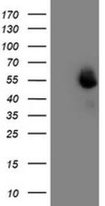 MEF2C Antibody in Western Blot (WB)