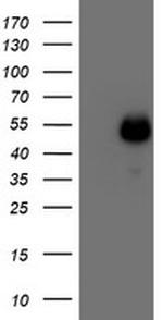 MEF2C Antibody in Western Blot (WB)