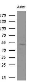 MEF2C Antibody in Western Blot (WB)