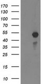 MEF2C Antibody in Western Blot (WB)