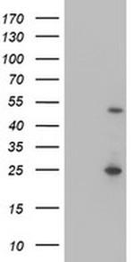 MEF2C Antibody in Western Blot (WB)