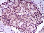 MEF2C Antibody in Immunohistochemistry (Paraffin) (IHC (P))