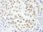 MEF2D Antibody in Immunohistochemistry (IHC)