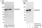 MEF2D Antibody in Western Blot (WB)