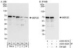 MEF2D Antibody in Western Blot (WB)