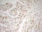 MEF2D Antibody in Immunohistochemistry (Paraffin) (IHC (P))