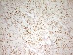 MEF2D Antibody in Immunohistochemistry (Paraffin) (IHC (P))