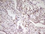 MEF2D Antibody in Immunohistochemistry (Paraffin) (IHC (P))