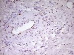 MEF2D Antibody in Immunohistochemistry (Paraffin) (IHC (P))