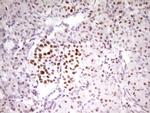 MEF2D Antibody in Immunohistochemistry (Paraffin) (IHC (P))