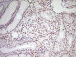 MEF2D Antibody in Immunohistochemistry (Paraffin) (IHC (P))