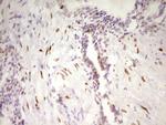 MEF2D Antibody in Immunohistochemistry (Paraffin) (IHC (P))