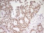 MEF2D Antibody in Immunohistochemistry (Paraffin) (IHC (P))