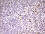 MEF2D Antibody in Immunohistochemistry (Paraffin) (IHC (P))