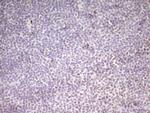 MEF2D Antibody in Immunohistochemistry (Paraffin) (IHC (P))