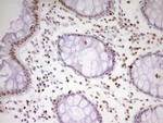 MEF2D Antibody in Immunohistochemistry (Paraffin) (IHC (P))