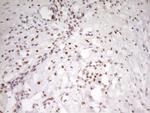 MEF2D Antibody in Immunohistochemistry (Paraffin) (IHC (P))